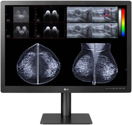[31HN713D] LG Diagnostic Monitor for Mammography, 31-inch 12MP 4200x2800 IPS Display, 1200 cd/m Brightness, DICOM Compliant, Pathology Mode, Focus View, Self Calibration, Ergonomic Stand, Black | 31HN713D